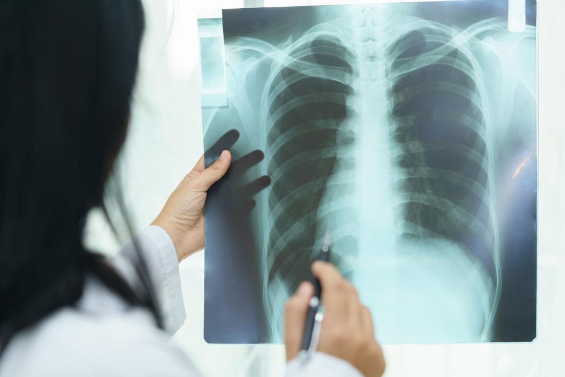 An infection or trauma may cause pulmonary edema