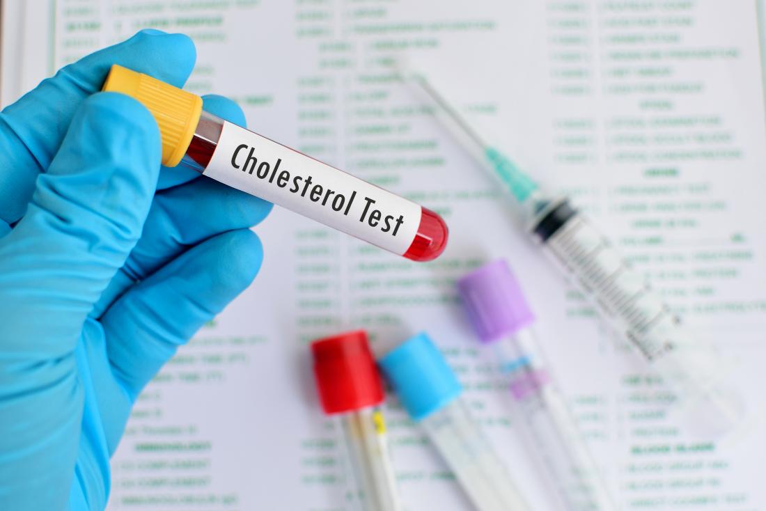 cholesterol blood test