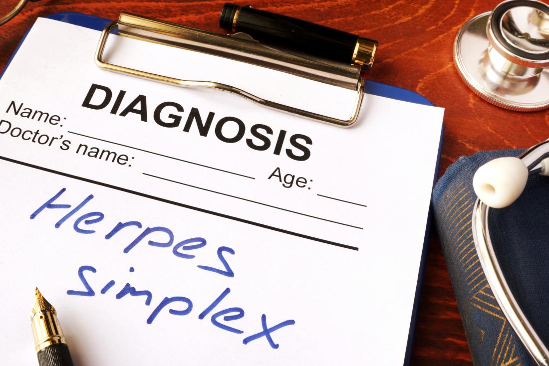 herpex simplex diagnosis concept photo