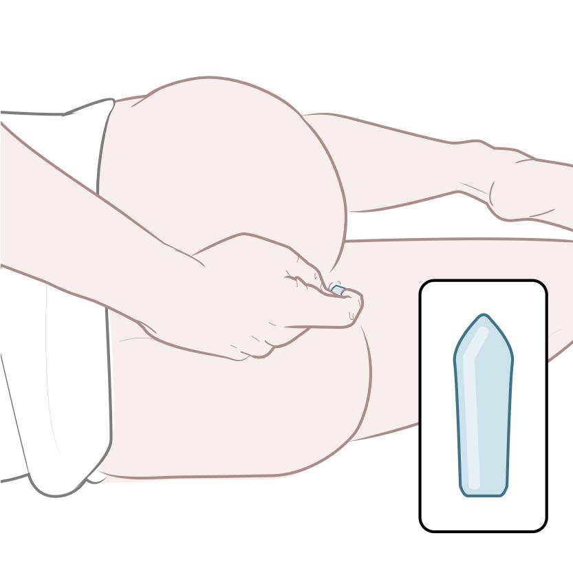 Inserting suppository - rectal suppository series