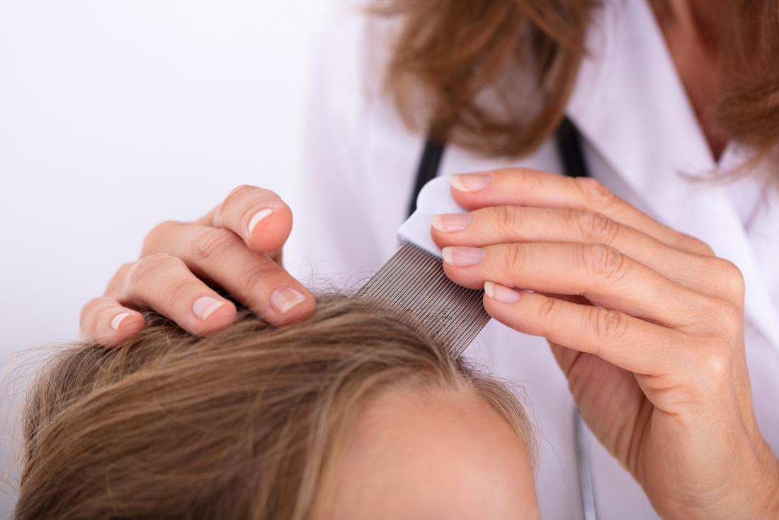 Doctor inspecting a girls scalp to determine if it's lice or dandruff