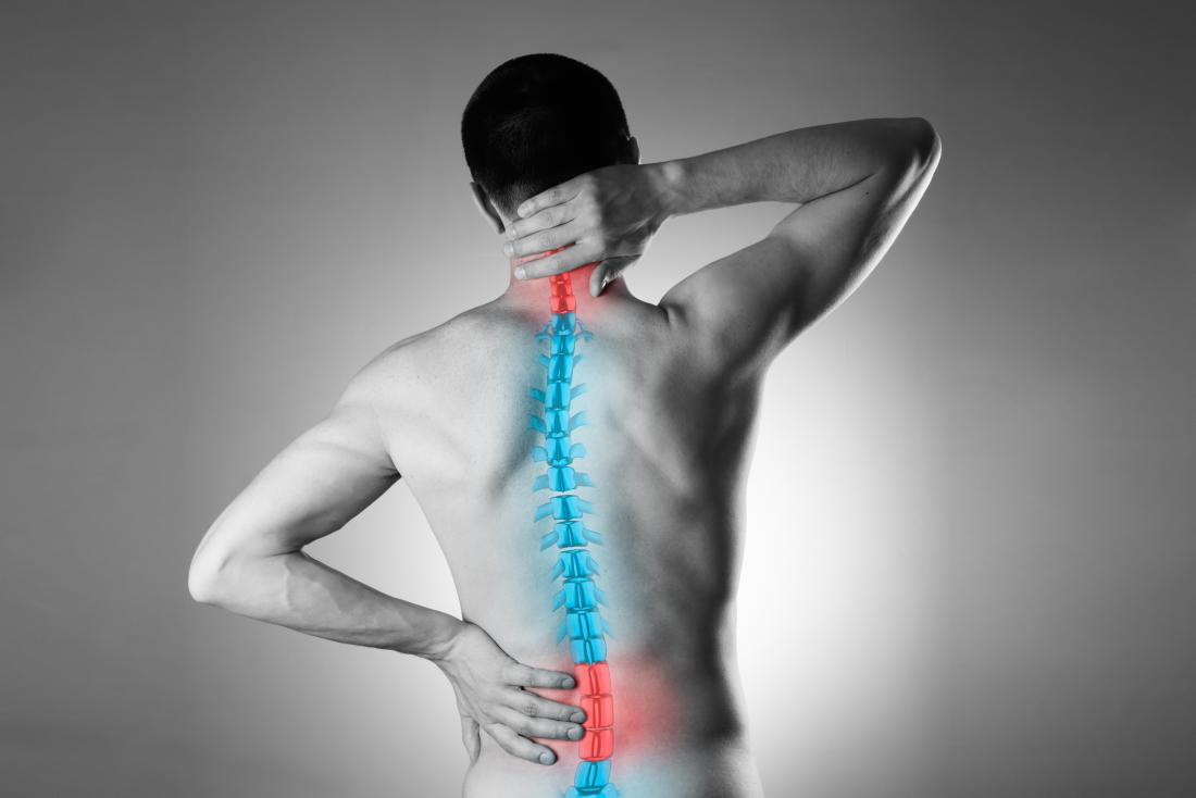 illustration of spine on man with back pain