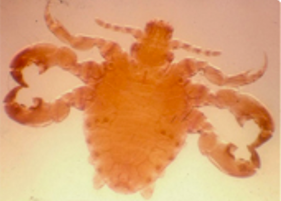 Microscopic close up of pubic lice. Image credit: Centers for Disease Control and Prevention, 2013.