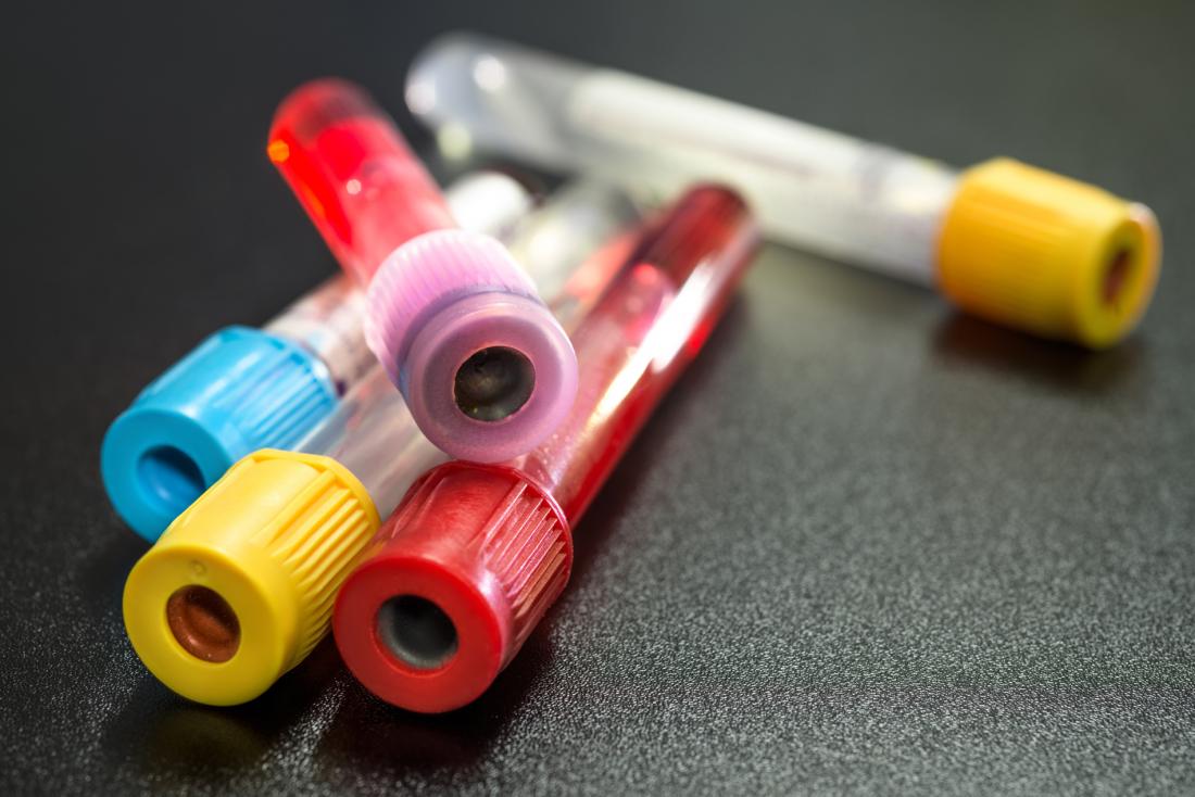 Blood samples in tubes for testing