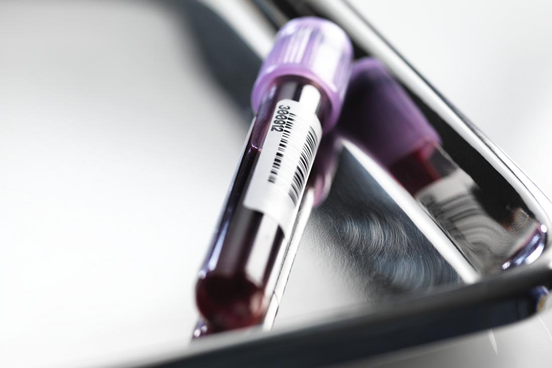 A blood test will help determine whether the integrase inhibitors are working.
