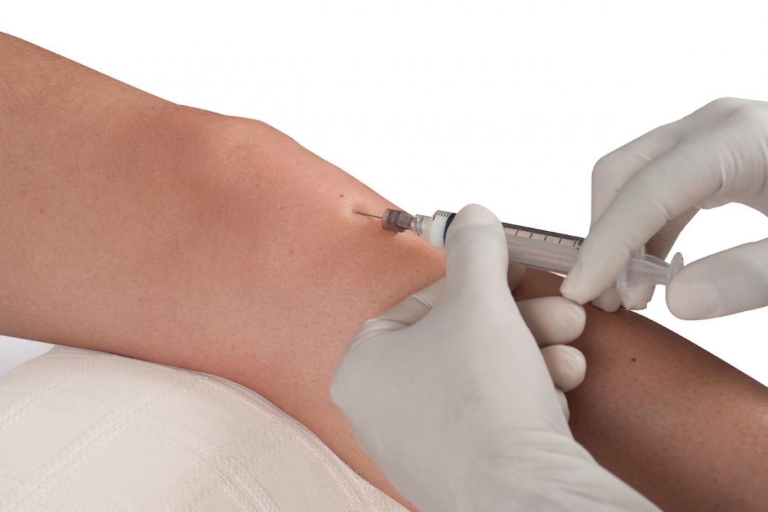 Person receiving prolotherapy injections to inflamed knee joint.