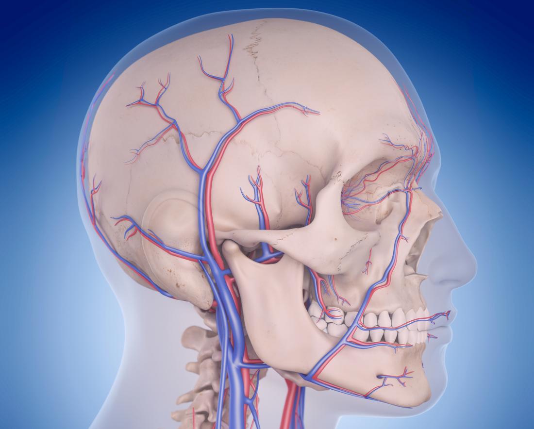 Image of blood flow to the brain and vertebrobasilar circulatory disorders