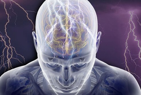 Epilepsy: Symptoms, Causes and Treatment