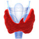 thyroid problem picture