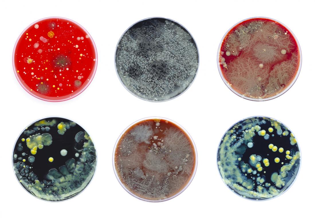 Petri dish bacteria