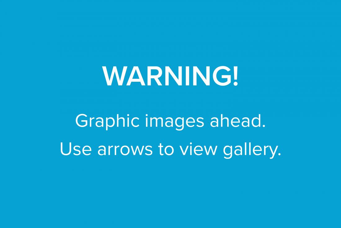 graphic image warning for carousel