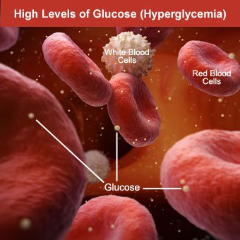 White hexagons in the blood represent glucose molecules which increase as a result of hyperglycemia.