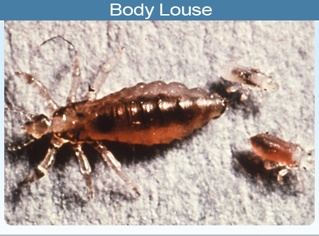 Photo of a body louse and larvae