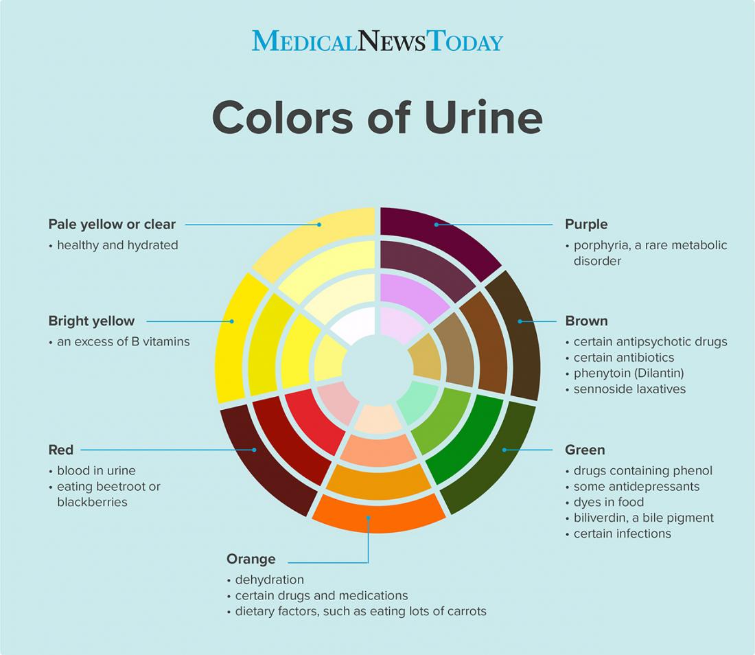 Colors of urine infographic