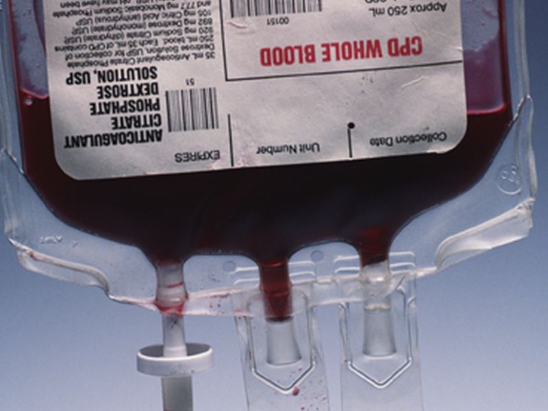 News Picture: What If You Were Your Own Blood Donor for Surgery?
