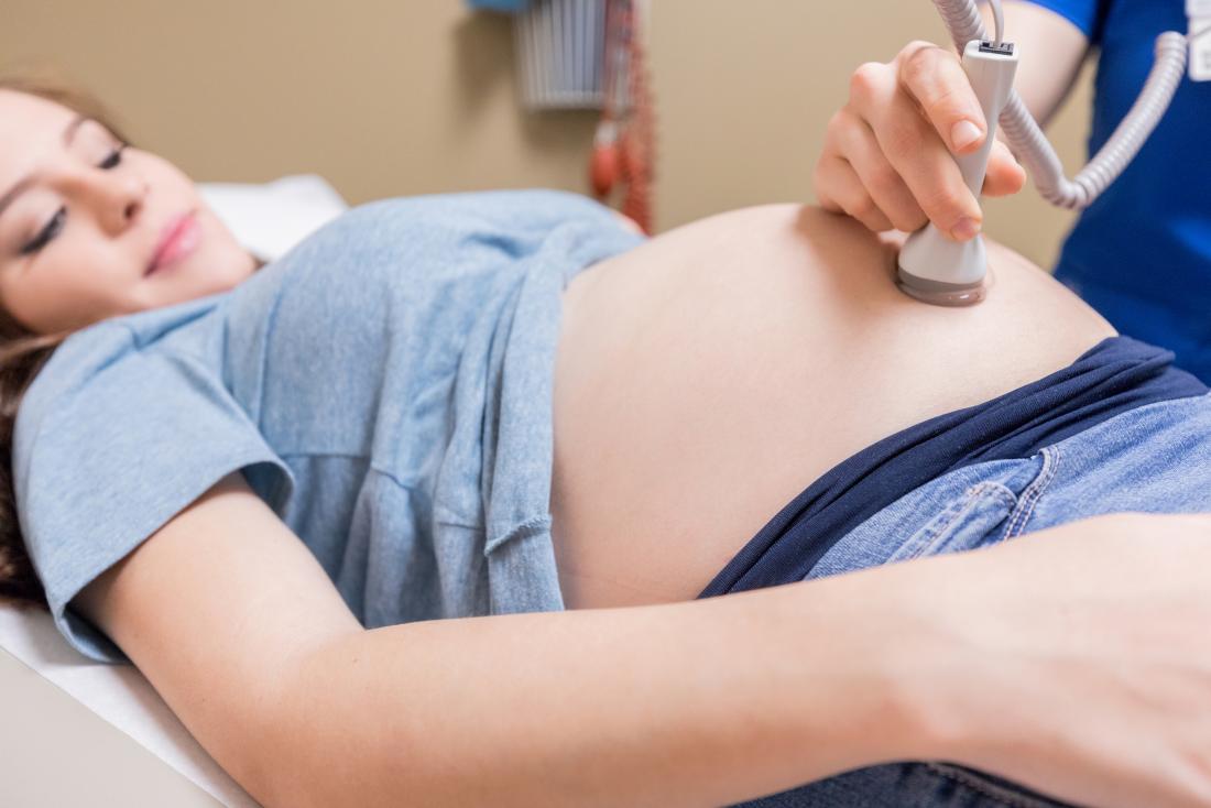 Pregnant woman having ultrasound scan