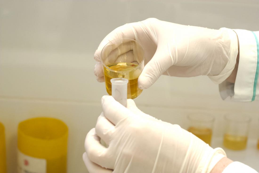 a urine test in a lab to find out why a person may have a constant urge to pee but little comes out