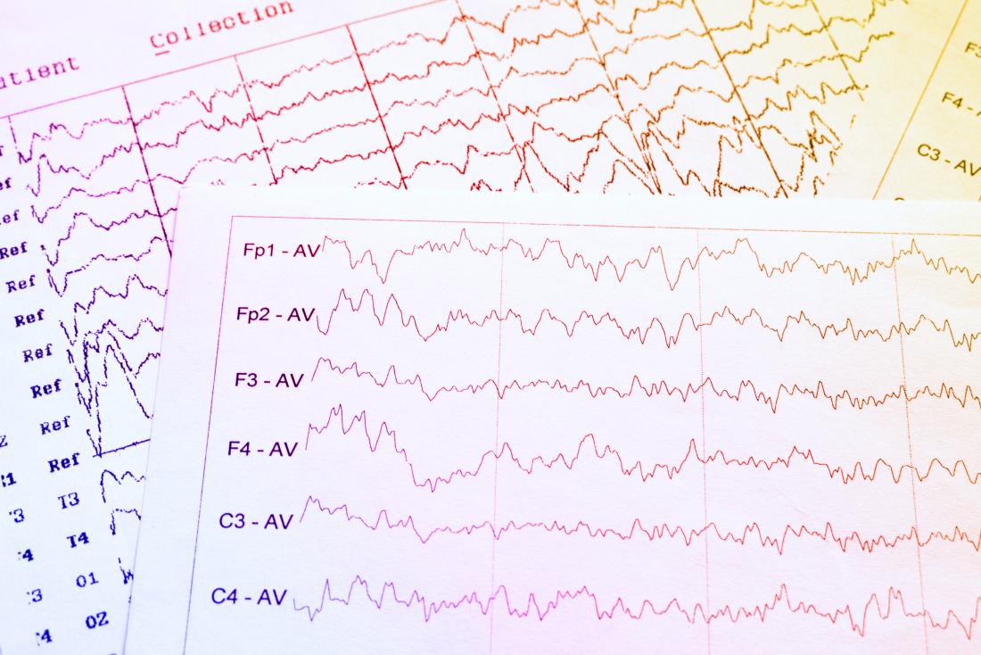 EEG results
