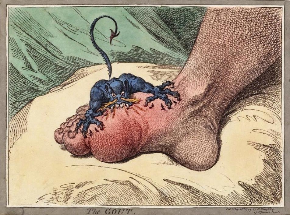 The Gout by James Gillray
