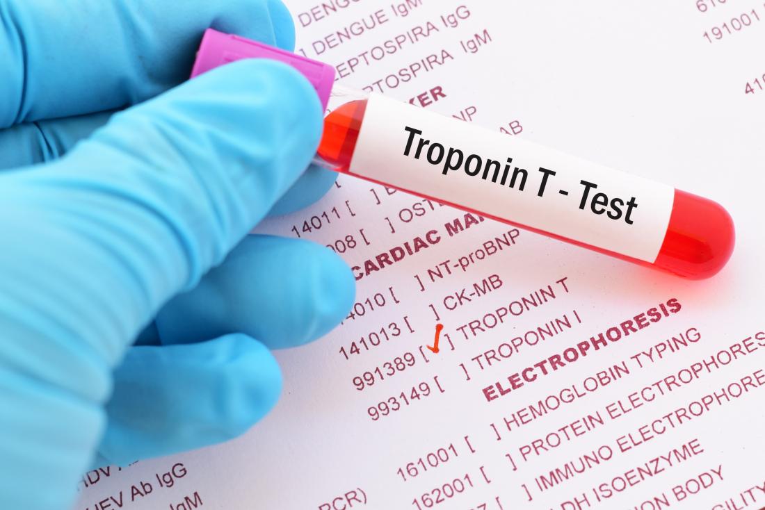 troponin T test
