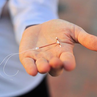 Intrauterine devices (IUDs) are a long term, yet impermanent, birth control method.