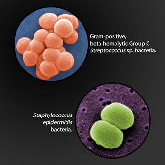 Microscopic images of strep (Streptococcus) and staph (Staphylococcus) bacteria.