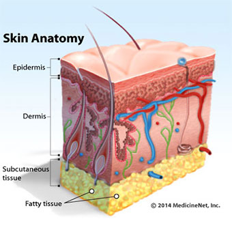 Illustration cross-section of the skin and where cellulitis occurs.