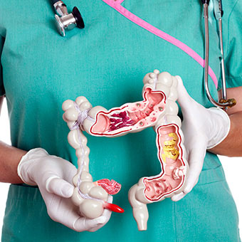 A nurse holds an anatomic model of a colon.