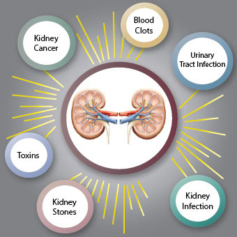 A chart showing specific causes of kidney pain.