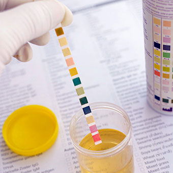 A health-care professional performs a urine test.