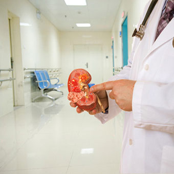 A doctor discussing kidney failure using an anatomical model of a human kidney.