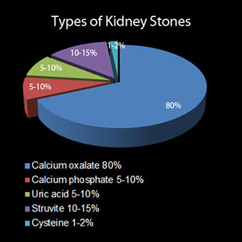 Chart showing types and causes of kidney stones.