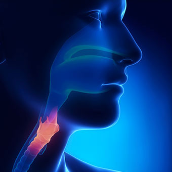 An X-ray illustration an inflamed larynx.