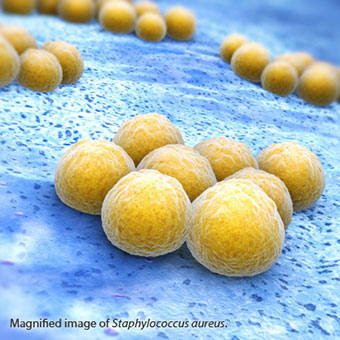 Magnified image of Staphylococcus aureus, which can be a complication of scabies.