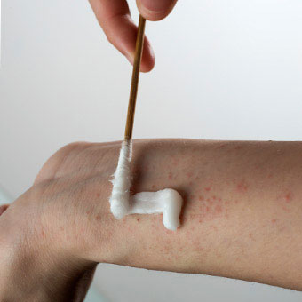 A skin rash being treated with a topical cream.