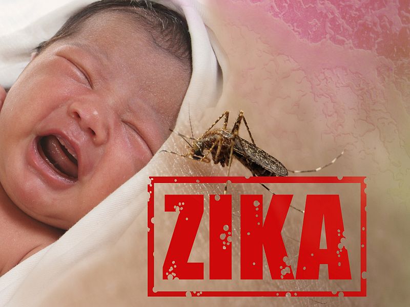 News Picture: Zika's Damage Continues in Children Infected Before Birth