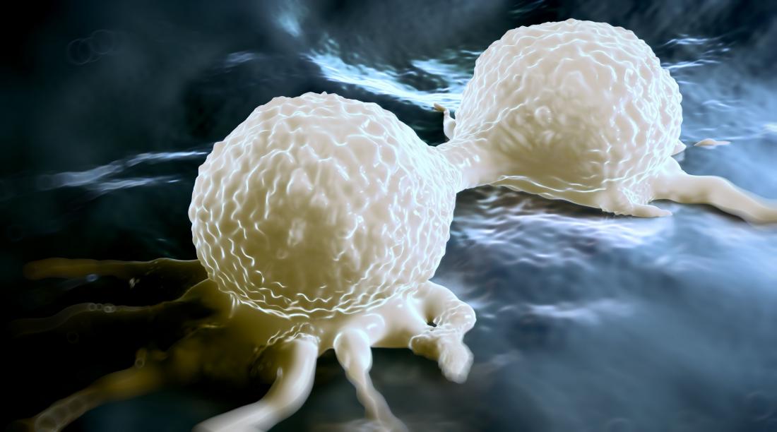 illustration of breast cancer cells spreading