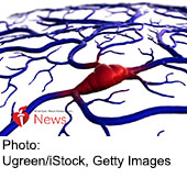 News Picture: AHA News: Unique Gene Activity Discovered in People With Both Stroke and Cancer