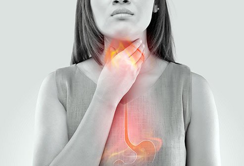 Photo illustration of a woman with esophageal pain.