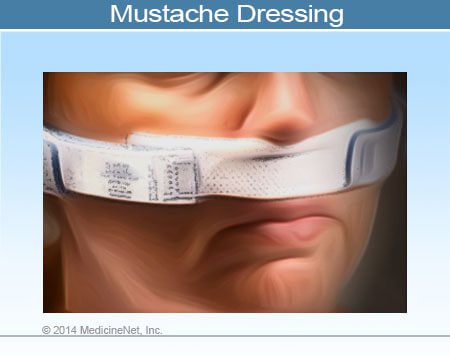 Picture of Mustache Dressing