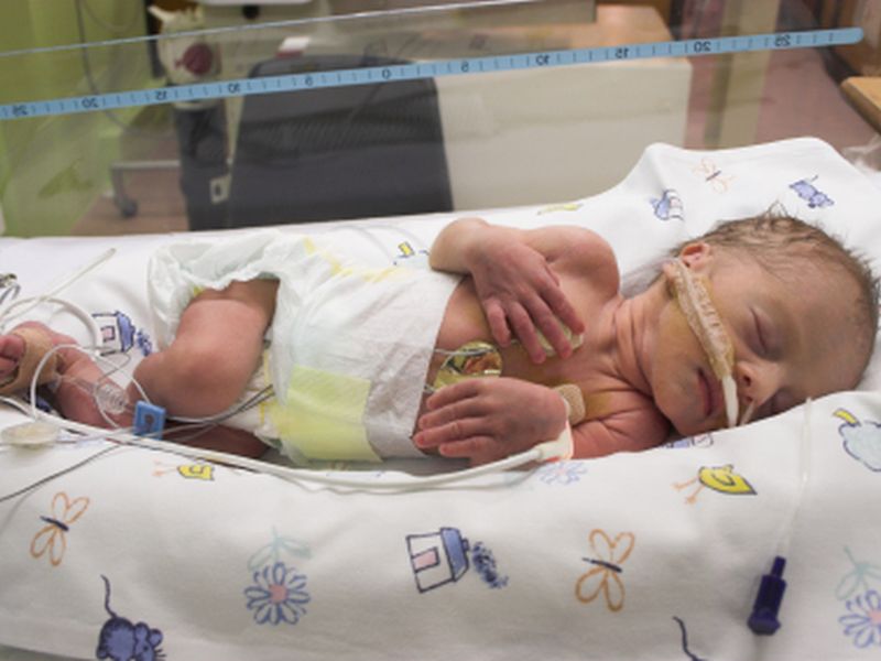 News Picture: Treatment for Very-Preterm Infants May Lead to Antibiotic Resistance