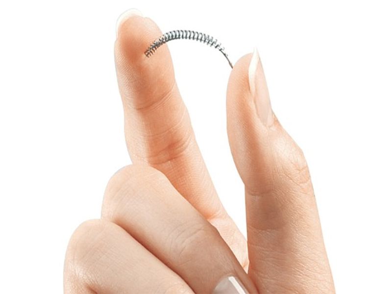 News Picture: Before Choosing an IUD for Birth Control, Know the Facts