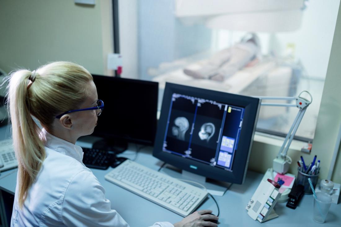 physician examining MRI scans