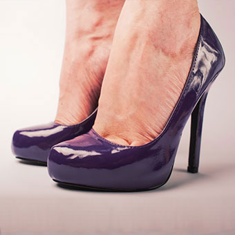 A woman wears shoes with a very high heel, which can cause corns and calluses.