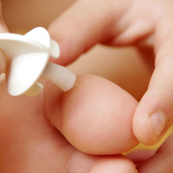 A person applies over-the-counter wart medications to treat corns and calluses.
