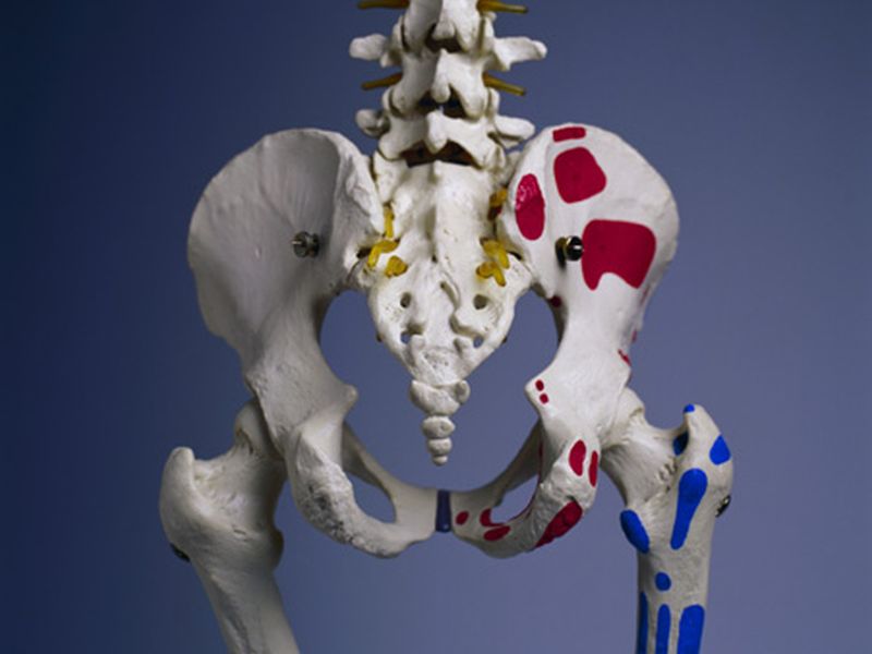 News Picture: Is Partial Hip Replacement Often the Better Option?