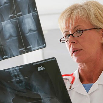 Before knee replacement surgery, a doctor will also examine other joints.