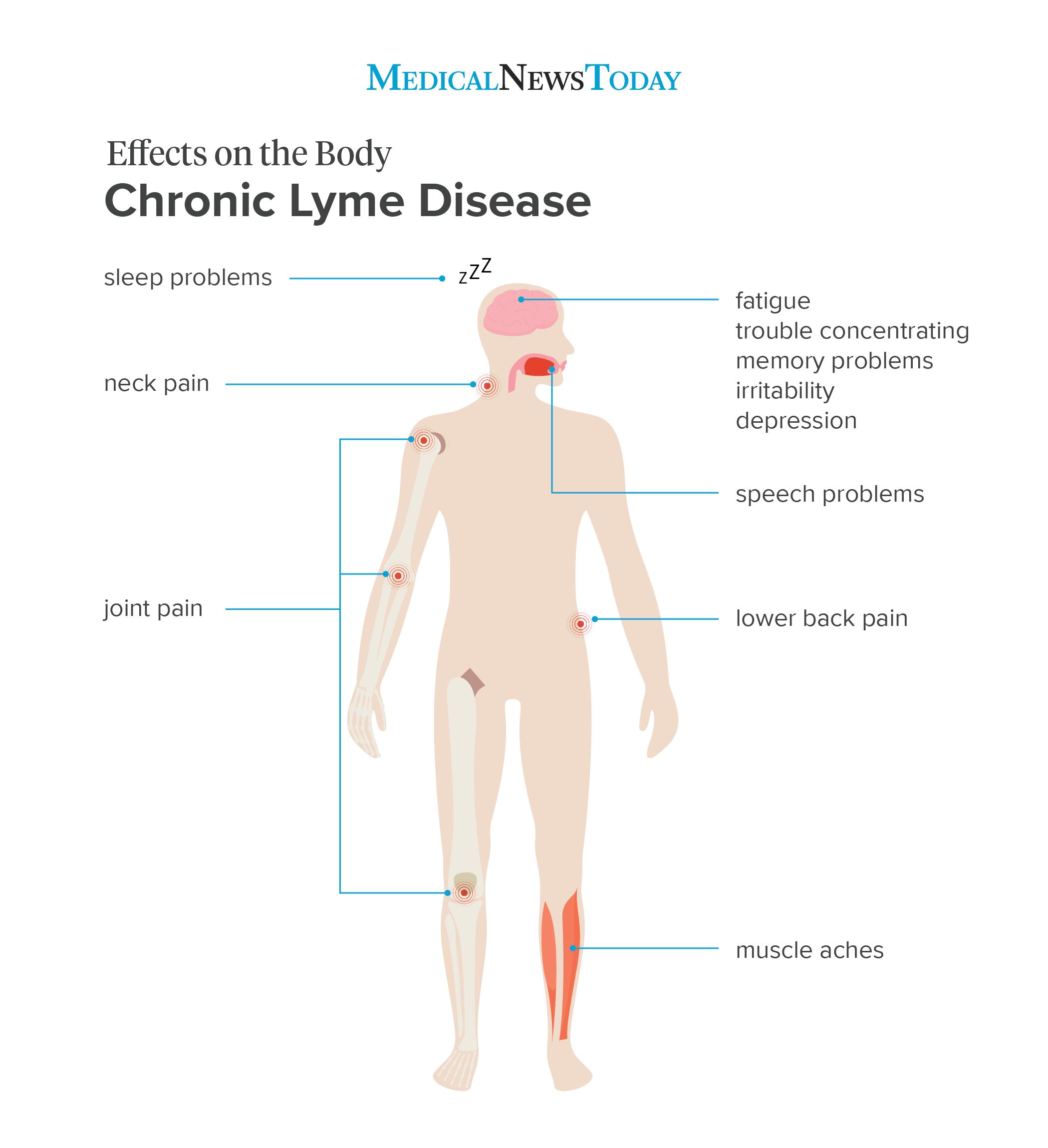 an infographic for chronic lyme disease