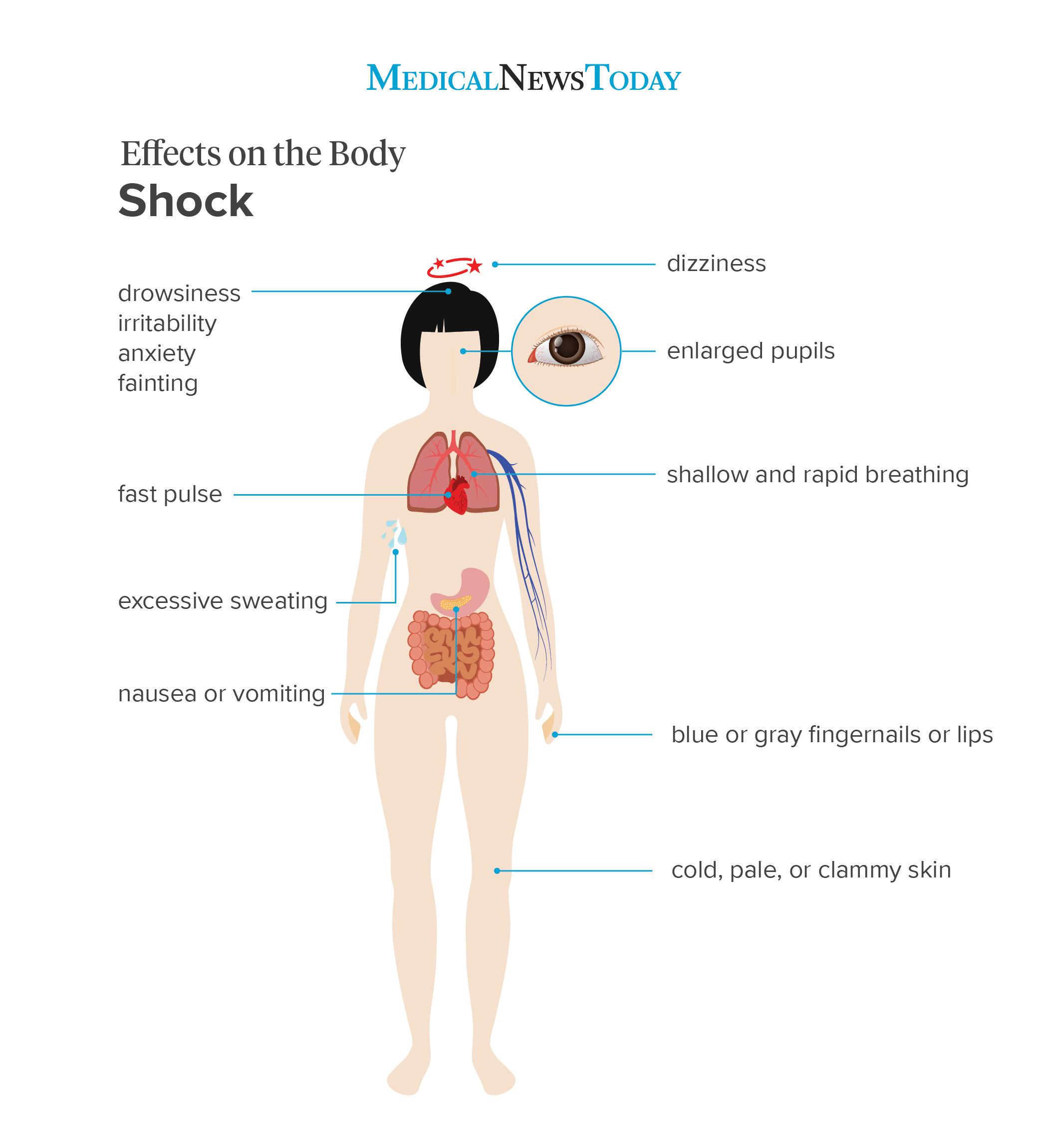 an infographic of effects on the body shock