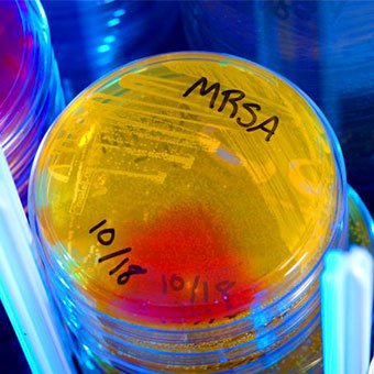 A petri dish culture plate demonstrates the growth of methicillin-resistant Staphylococcus aureus (MRSA) bacteria.
